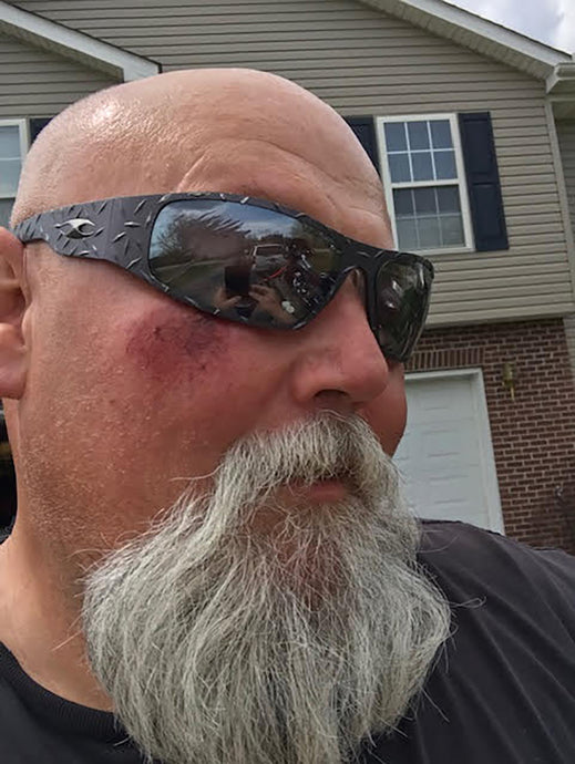 How Icicles®Motorcycle Glasses Saved One Biker's Eye